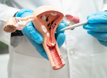 Uterus, doctor holding anatomy model for study diagnosis and treatment in hospital.