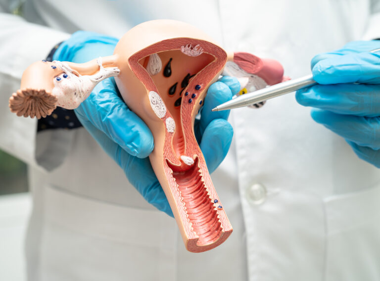 Uterus, doctor holding anatomy model for study diagnosis and treatment in hospital.